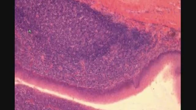 НЕБНАЯ МИНДАЛИНА. PALATINE TONSIL. В световой микроскоп.