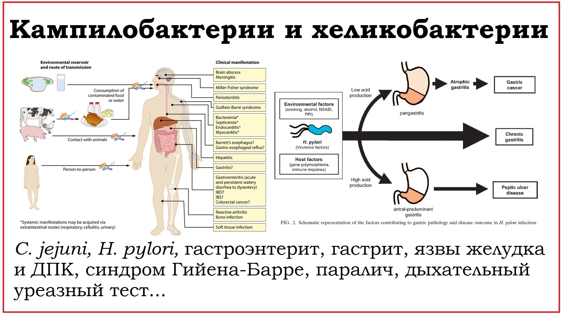 32. Клинически значимые бактерии родов Campylobacter и Helicobacter