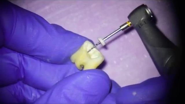 dr Andrii Sapeliuk, Ukraine смотреть онлайн