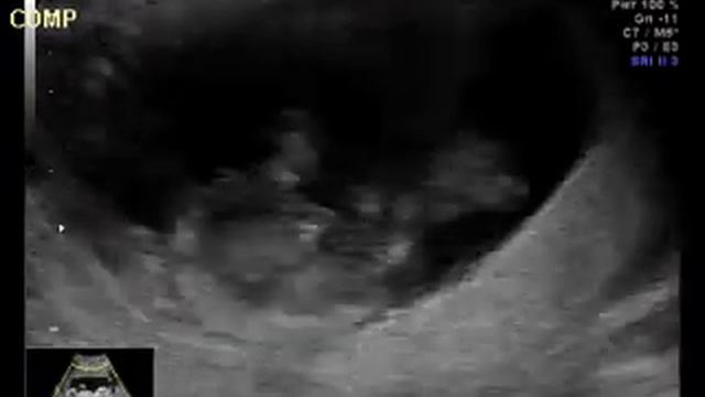 Смысл жизни! смотреть онлайн