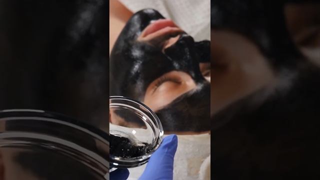 Карбоновый пилинг✨ смотреть онлайн