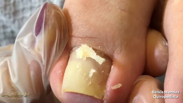 Pedicura Profunda LANSSTUDIOS смотреть онлайн