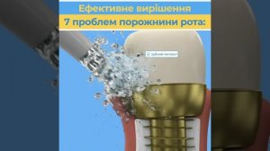 Ефективне вирішення 7 проблем порожнини рота