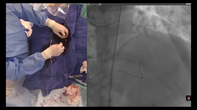 Imagésanté 2016 : Live opérations - #Vendredi 18/03 Matin смотреть онлайн