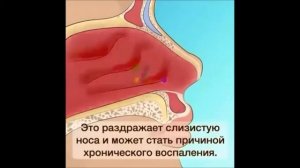 Шок! Почему нельзя ковыряться в носу!????
