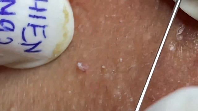 Enjoy Every Day With The Best Video Loan Nguyen Spa Official | 959 смотреть онлайн