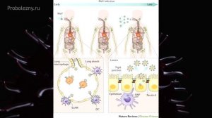 "Корь" - об инфекции