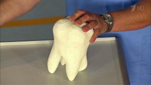 Спросите корифея. Трудные вопросы врачу-стоматологу. Жить здорово! Фрагмент выпуска от 07.12.2015