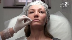 Делаем контур губ