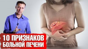 10 признаков умирающей печени ☠️ Печеночная недостаточность