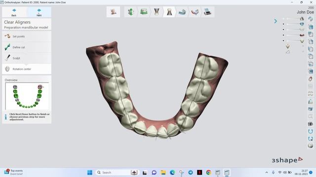 3 Shape ! Clear Aligner Automatic ! installation v2023. Telegram- Johndoe7011 , +15757881955 смотреть онлайн