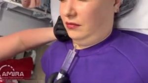 Мезотерапевтическая липосакция подбородка✨