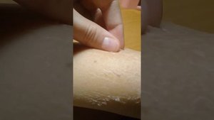 У Кати слазит кожа