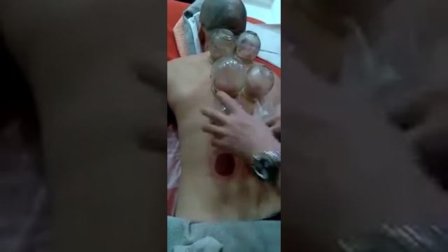 Кровопускание в китайском салоне. Слабонервным не смотреть!
