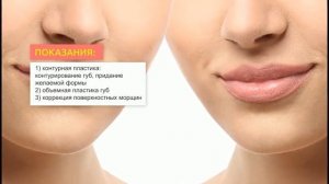 Филлер Stylage Special Lips Lidocaine | 2Filler.ru