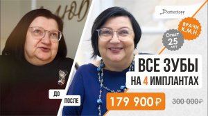 Видео отзыв, All on 4 альтернатива, +7 (495) 255-59-37 восстановление всех зубов до/после. 18+