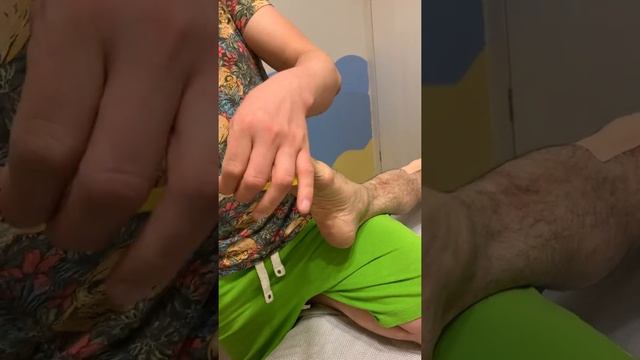 Кинезиотейпирование при плоскостопии
