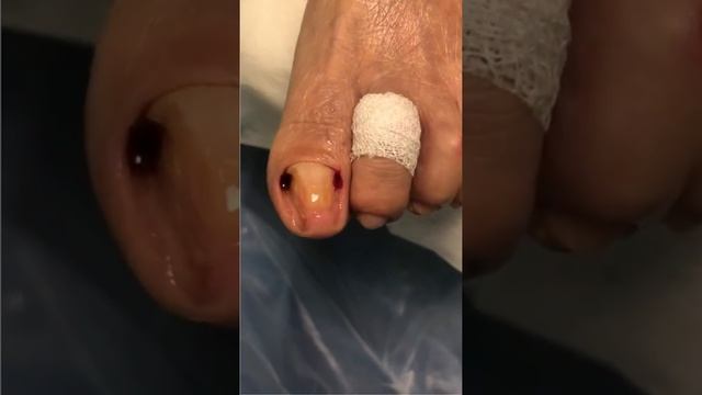 Прием у подолога смотреть онлайн