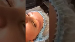 Как удалить татуаж бровей  татуремувером?