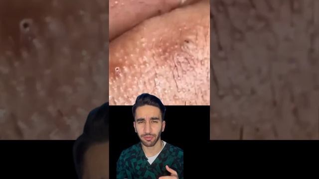 механическая чистка лица