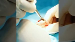 Удаление инородного тела из кишечника кошки