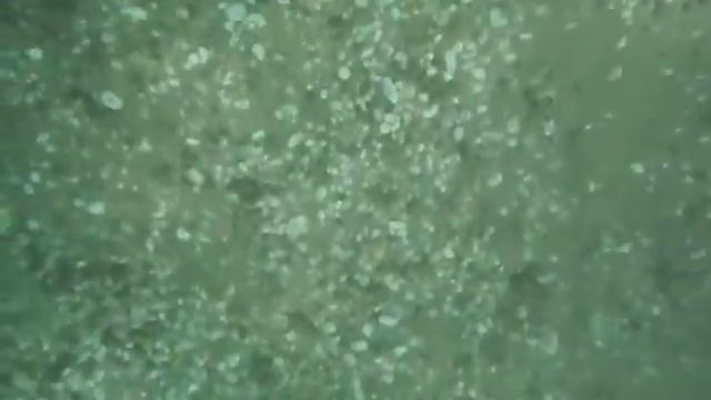 Медузы черного моря.