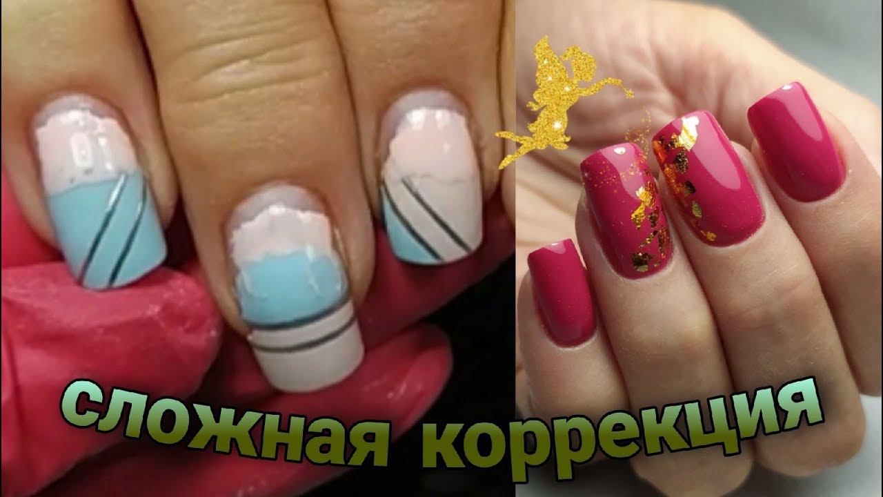 сложная коррекция переношенных ногтей