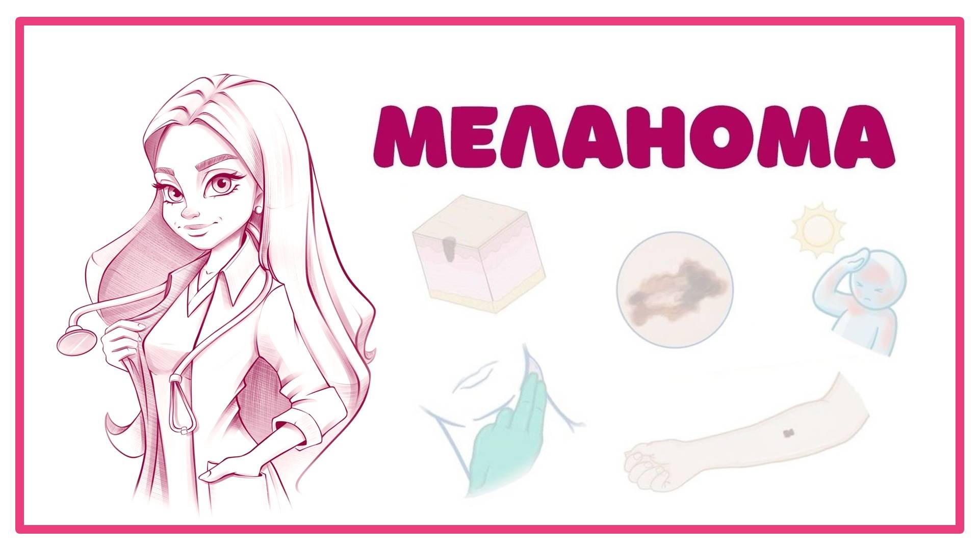 Меланома - причины, симптомы, диагностика, лечение (дерматология онкология) лекция