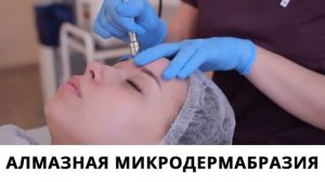 Косметолог Анастасия о процедуре Алмазная микродермабразия