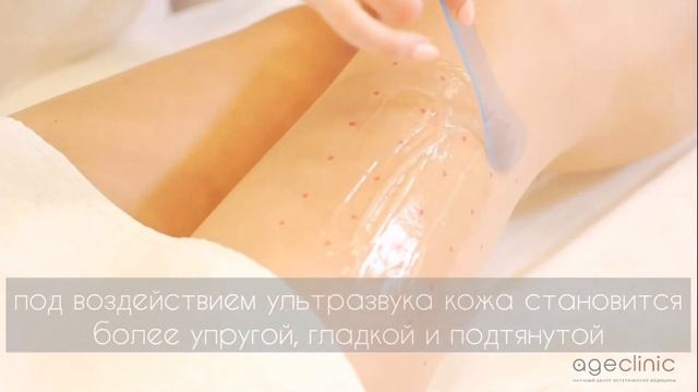 SMAS лифтинг на аппарате ULTRAFORMER | Ультраформер | AgeClinic