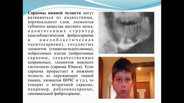Лекция Доброкачественные новообразования