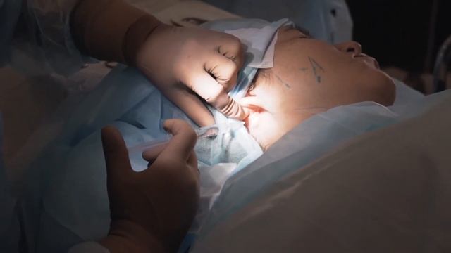 Как сделать молодым и красивым контур и овал лица и надолго? Есть решение - нити Эластикум ? смотреть онлайн