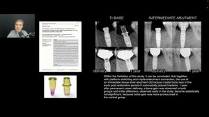 Jorge Andre CARDOSO – Протезирование на имплантатах с учетом долгосрочной стабильности мягких тканей