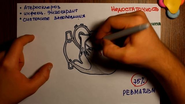 Митральная недостаточность - 