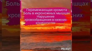 ?Матрица Гаряева Перемежающаяся хромота.