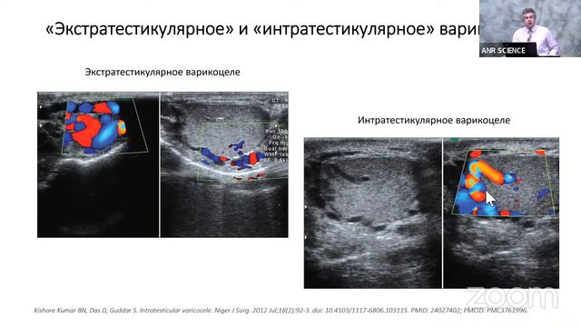 Излечим ли гипергонадотропный гипогонадизм у мужчин?
