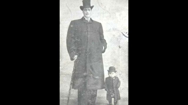 Из Карлика в Великана!.... История Адама Райнера смотреть онлайн