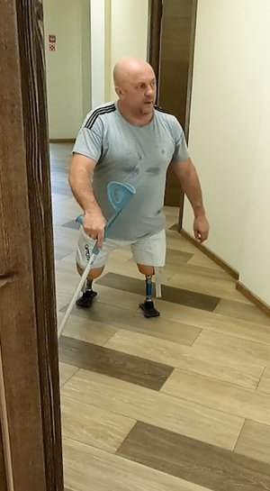 Без обеих ног учится ходить на протезах