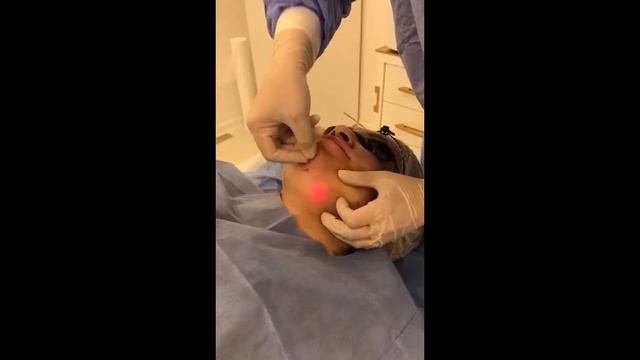 Липосакция -Избавление от лишних жировых отложений лазером 980нм смотреть онлайн