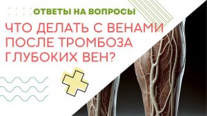 ВЕНЫ ПОСЛЕ ТРОМБОЗА ГЛУБОКИХ ВЕН