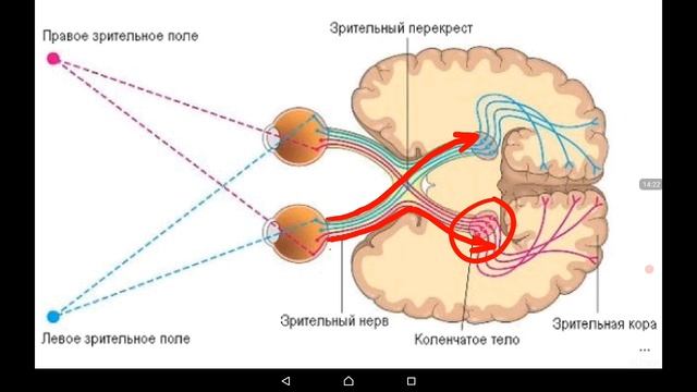 Последовательность зрительного импульса. Зрительный Перекрест и зрительный тракт. Зрительный нерв тракт и Перекрест. Зрительный путь схема 1 Нейрон. Зрительный нерв зрительный Перекрест зрительный тракт.