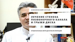 Множественный стеноз позвоночного канала. Лечение грыжи диска. Лечение стеноза позвоночника. Отзыв.