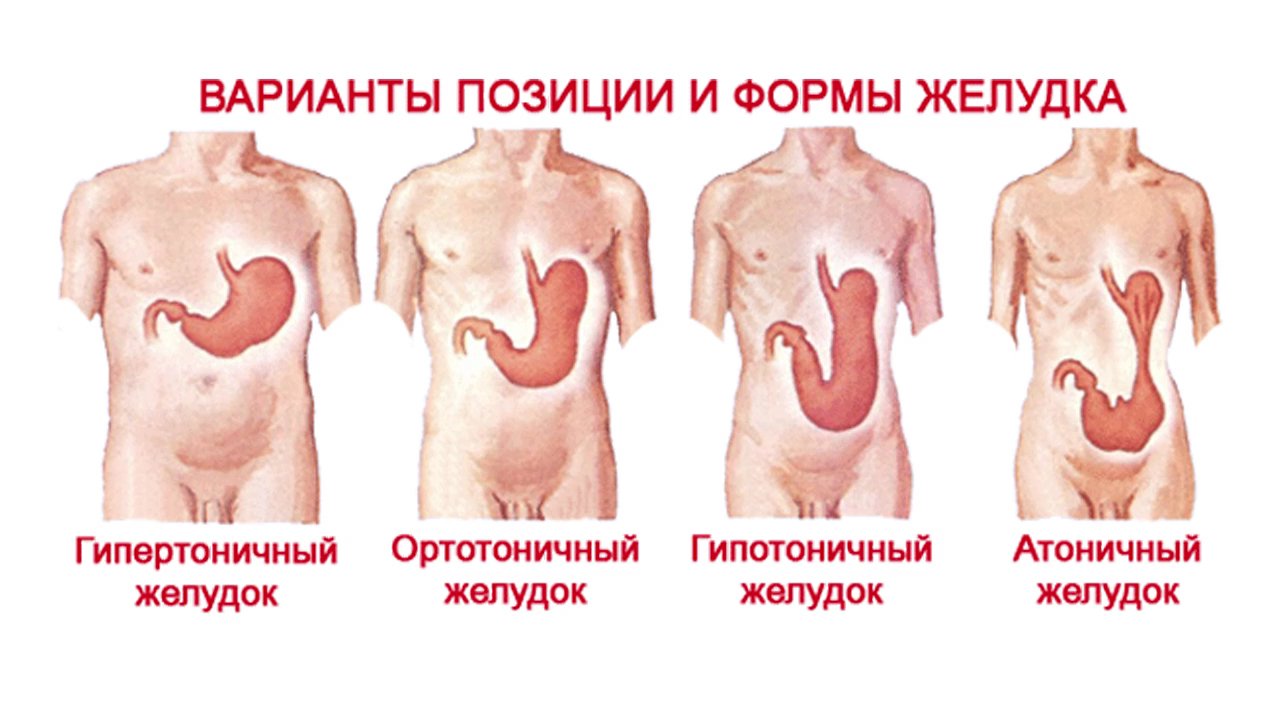 О желудке и кислотном рикошете