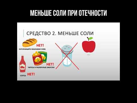Меньше соли при отёчности смотреть онлайн