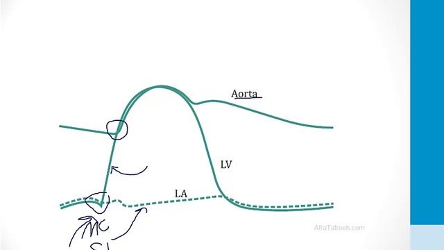 Кардиология USMLE - 1. Анатомия и физиология - 7.Диаграмма Виггерса