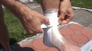 Тейпирование голеностопного сустава