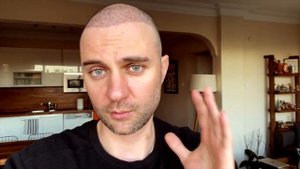 4 месяца после пересадки волос. Поперло?! / Красавчик