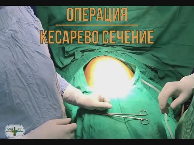 Кесарево сечение: показания согласно клиническим рекомендациям, варианты доступа