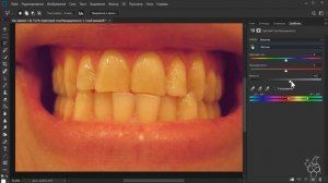 Как отбелить зубы от жёлтого налёта. Продвинутый метод!