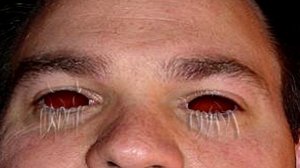 SCP-679 Eyerot | Object class keter